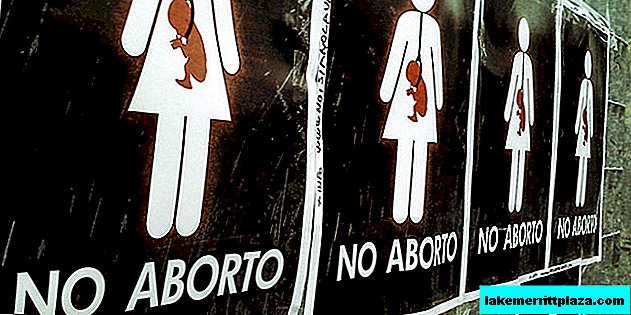 Médicos italianos se niegan a abortar